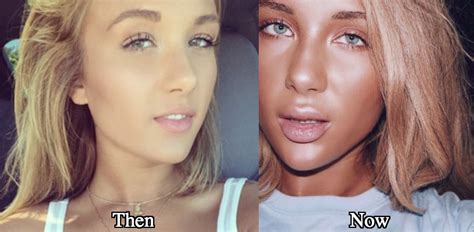 niykee heaton boobs|Niykee Heaton Plastic Surgery Photos Before and After